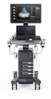 Viv 60 Trolley Ultrasound
